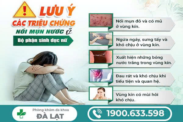 Hình ảnh minh họa